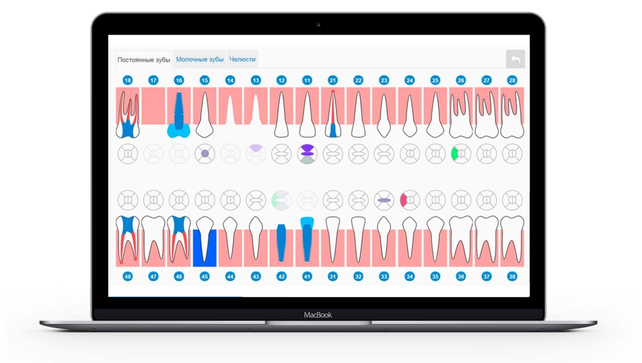 Программа для стоматологии | Dentist Plus