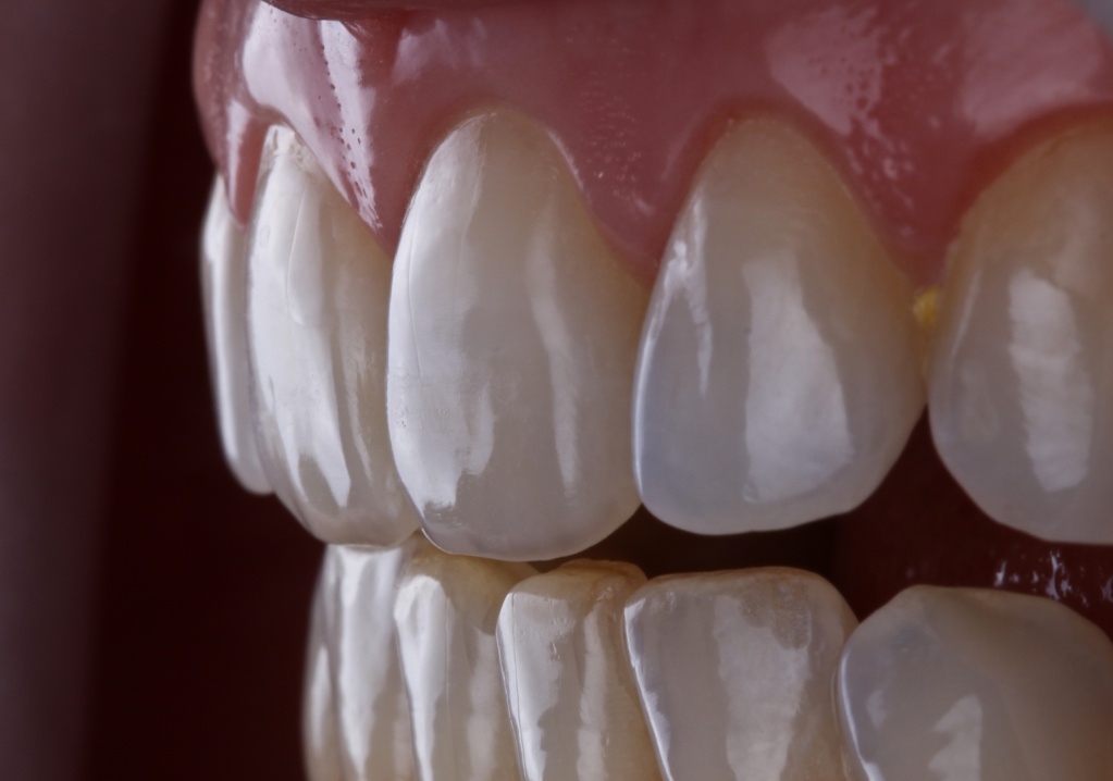 фото зубов на фотопротокол