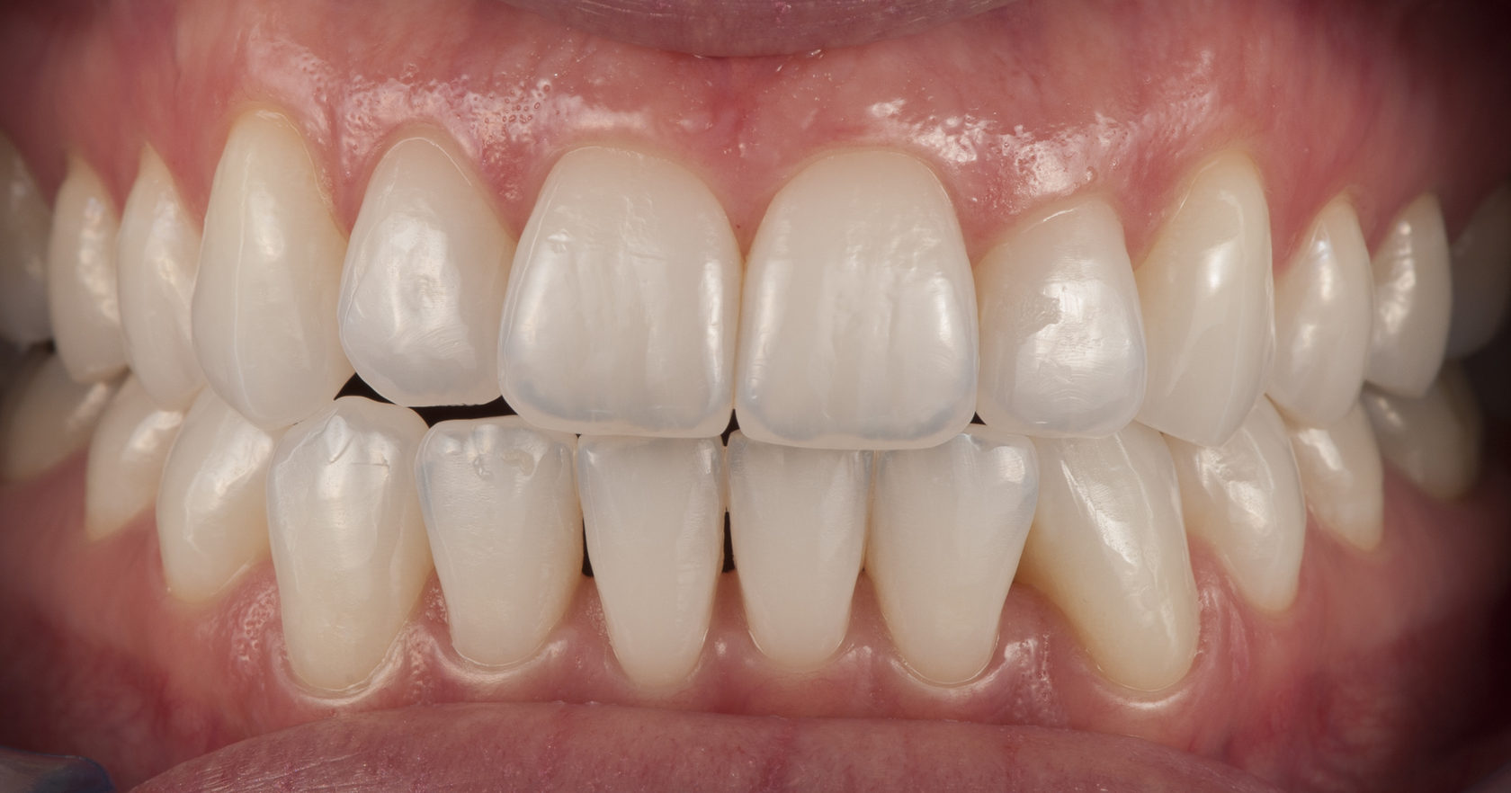 фотопротокол снимок стоматология